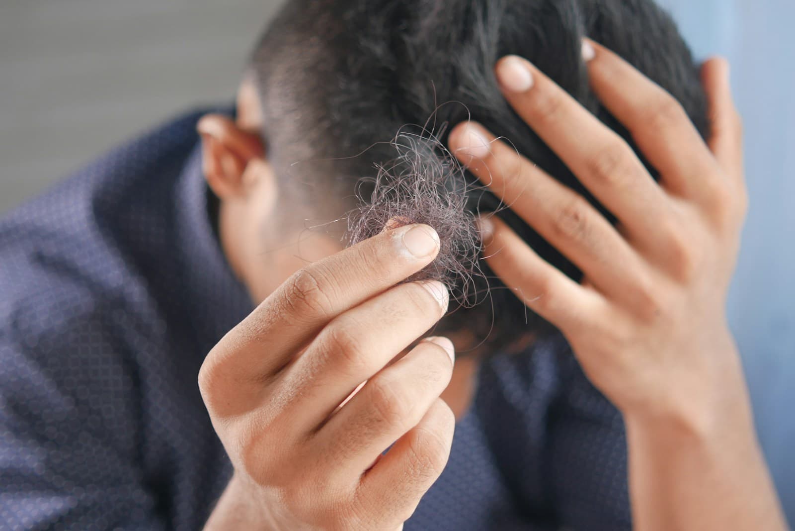 Hair Loss Treatment at Dr. Torun's Clinic